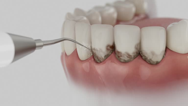 Reliable Dental contractor in North Baltimore, OH by Dentist Open Now